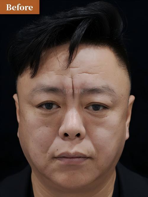 太保24小时在线套医保微信能用吗怎么弄？官方解答来了